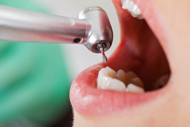 Best Emergency Dental Services for Seniors in Arbutus, MD